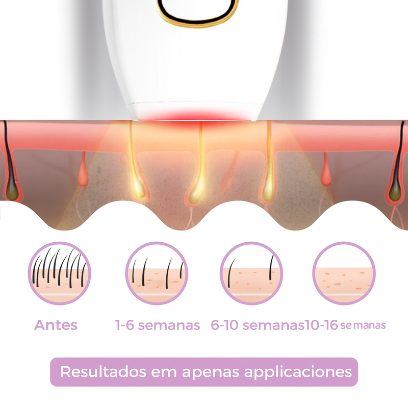 Depilador Corporal em Laser IPL GlowSkin I Pele Lisa em Minutos
