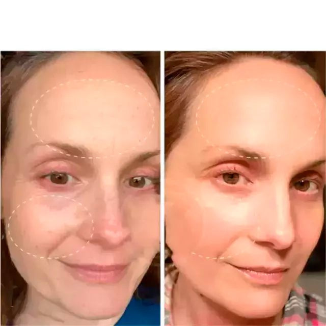 Massageador Facial Rejuvenescedor com Fototerapia Anti-Rugas